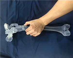 3D 프린팅 기술로 제작된 폴리머소재 인공 뼈(고대구로병원 제공)