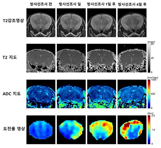 방사선 조사 전후의 뇌영역 신호변화 영상 비교(한국원자력의학원 제공)