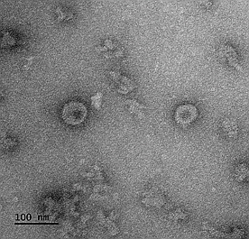 코로나19 바이러스항원으로 구성된 바이러스유사체 투과 전자현미경 이미지(국립보건원 제공)