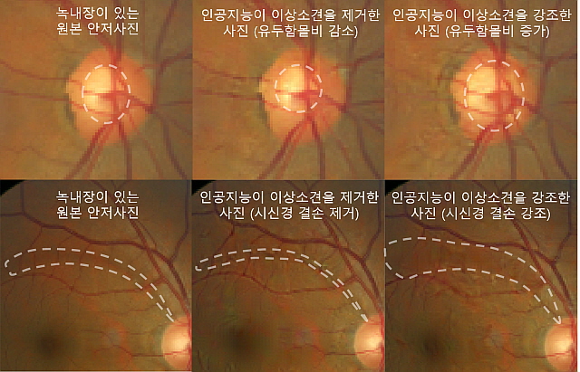 원본 안저사진(왼쪽)과 적대적 설명 방법론을 적용해 생성된 안저사진(가운데, 오른쪽)