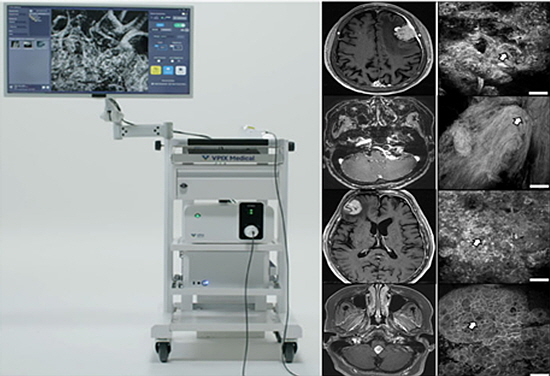 (왼쪽부터) cCeLL, 다양한 뇌종양MRI, cCeLL 촬영 영상