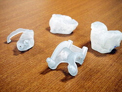 3D 프린터로 재현한 환자 무릎관절과 맞춤형 인공관절 수술 도구(PSI)