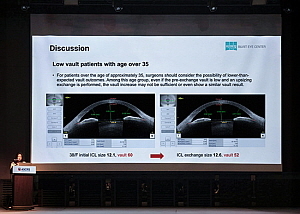 비앤빛안과 최한뉘 원장 美학회서 고난도 렌즈교체술 강의 - 뉴스 썸네일 이미지